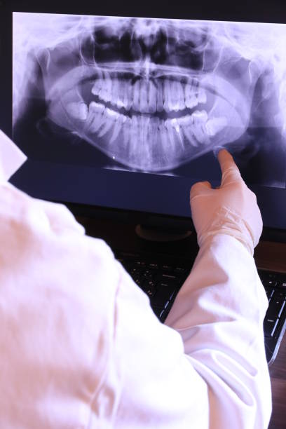 Best Emergency Treatment for Oral Infections in Lake Ronkonkoma, NY
